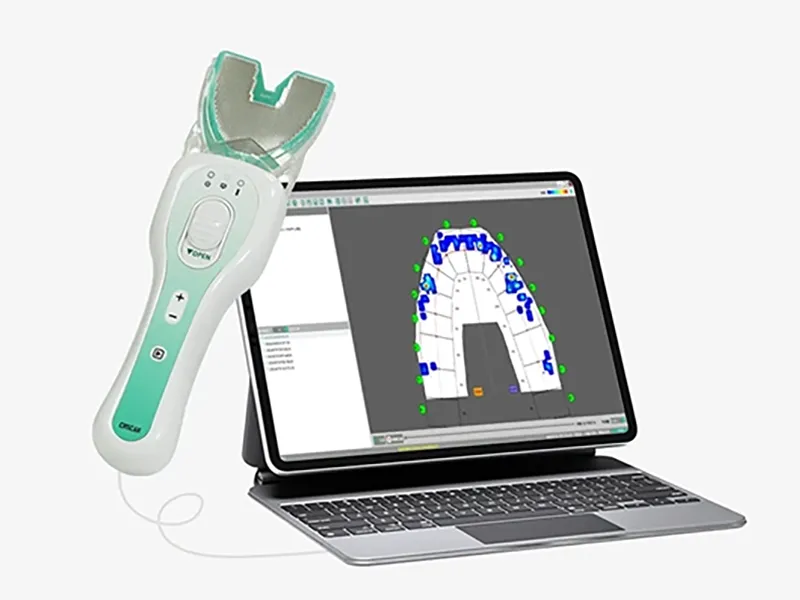 Dental occlusal pressure mapping system for bite analysis